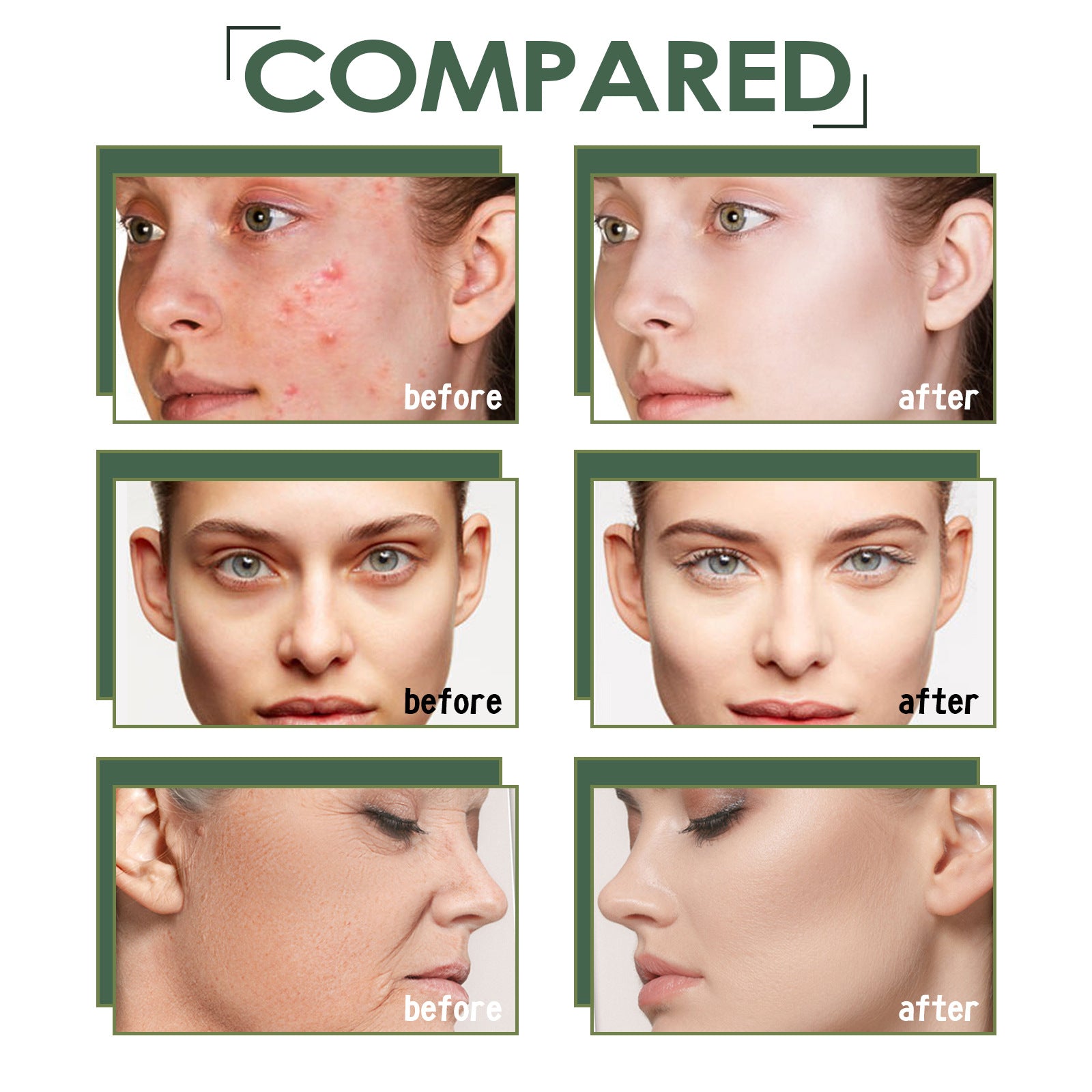 Peau lumineuse avec des taches d&